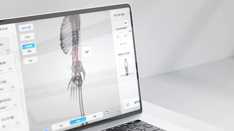 3D 전신 골격 모델에 척추 각도가 숫자로 표시된 분석 화면