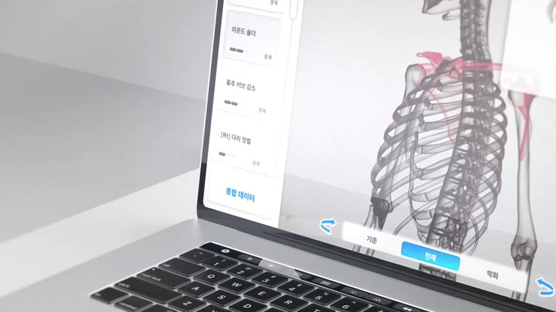 갈비뼈와 근육이 함께 표시된 모티피지오 분석 화면
